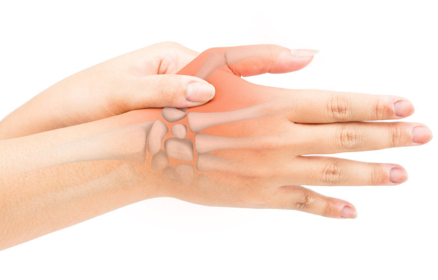 אוסטאוארטריטיס באצבעות הידיים